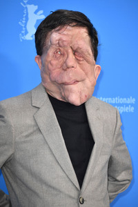 Photocall 'A Different Man', Berlinale 2024