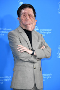 Photocall 'A Different Man', Berlinale 2024