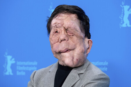 Photocall 'A Different Man', Berlinale 2024