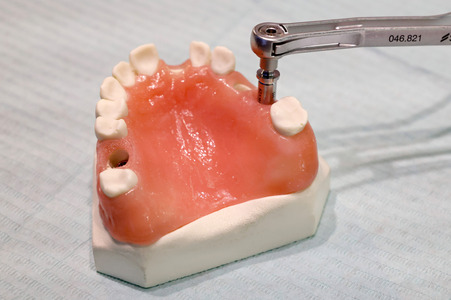 Internationale Dental-Schau - ITS 2025 in Köln