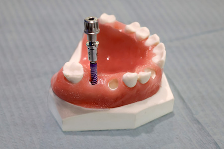 Internationale Dental-Schau - ITS 2025 in Köln