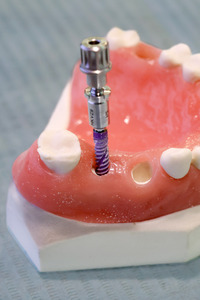 Internationale Dental-Schau - ITS 2025 in Köln