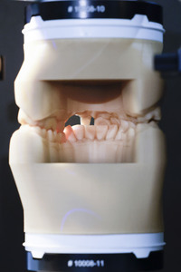 Internationale Dental-Schau - ITS 2025 in Köln
