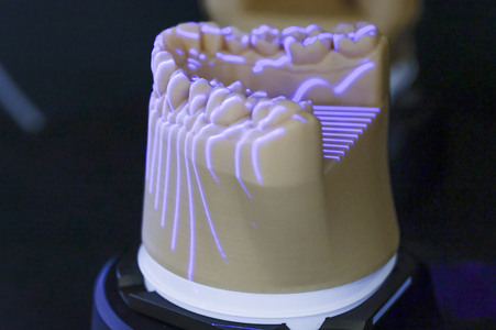 Internationale Dental-Schau - ITS 2025 in Köln