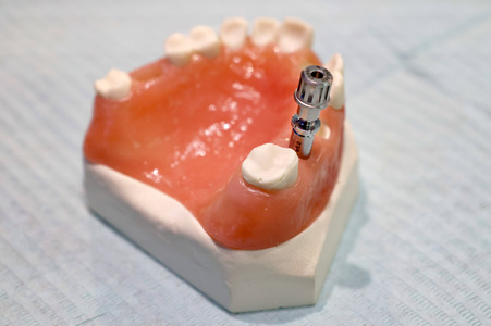Internationale Dental-Schau - ITS 2025 in Köln