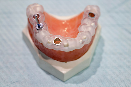 Internationale Dental-Schau - ITS 2025 in Köln