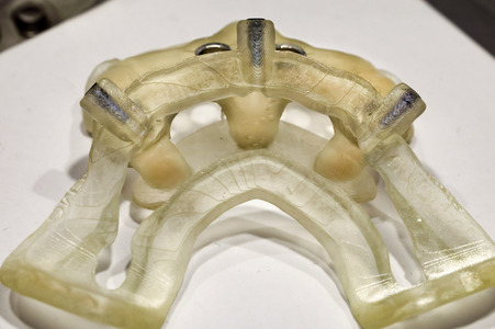 Internationale Dental-Schau - ITS 2025 in Köln