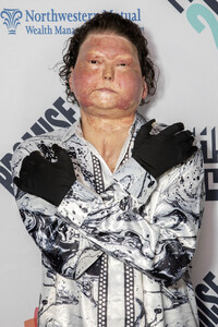 Promise2Live Global Livestream Event in Los Angeles