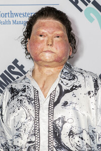 Promise2Live Global Livestream Event in Los Angeles